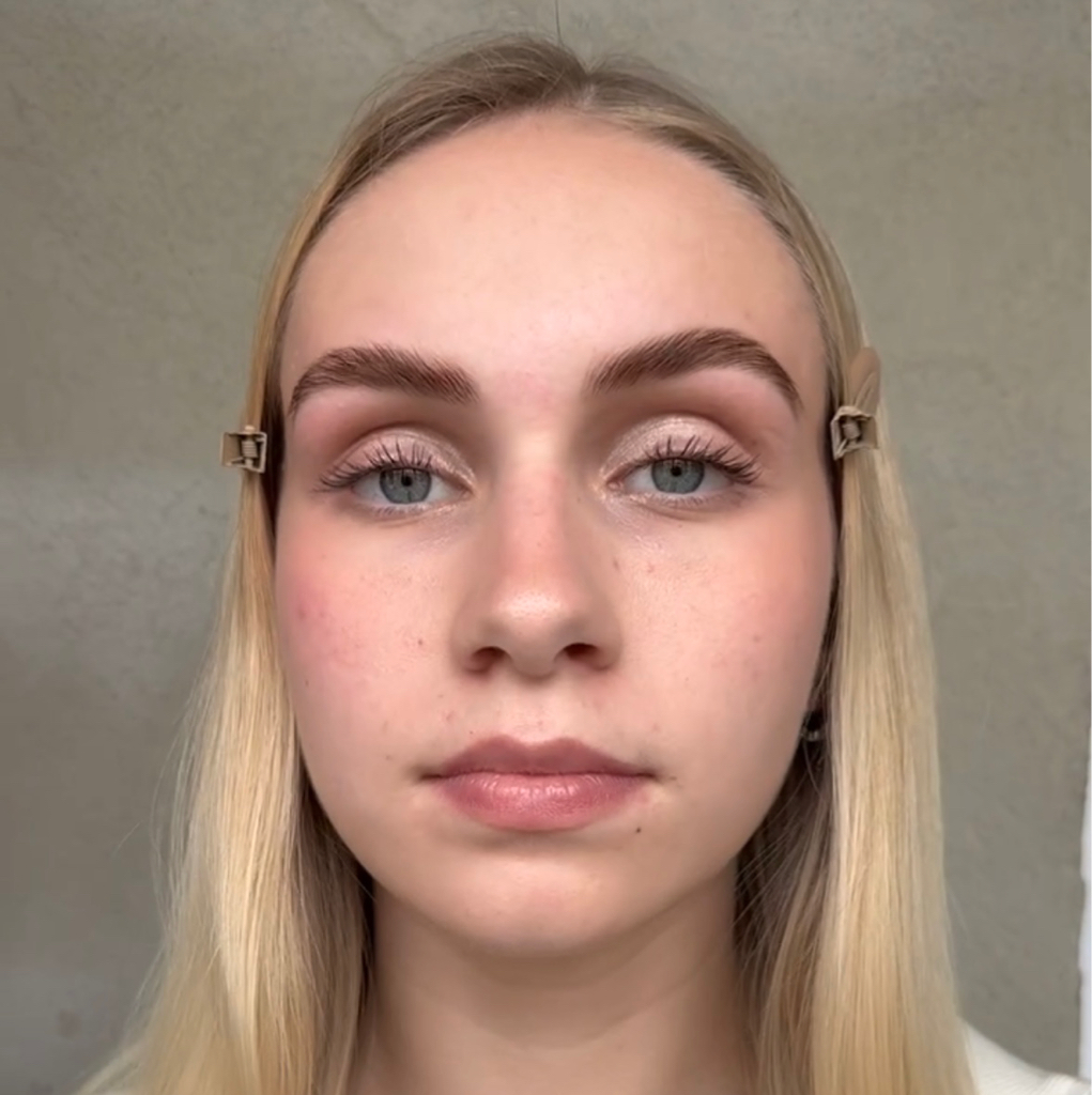 Удаление волос на лице