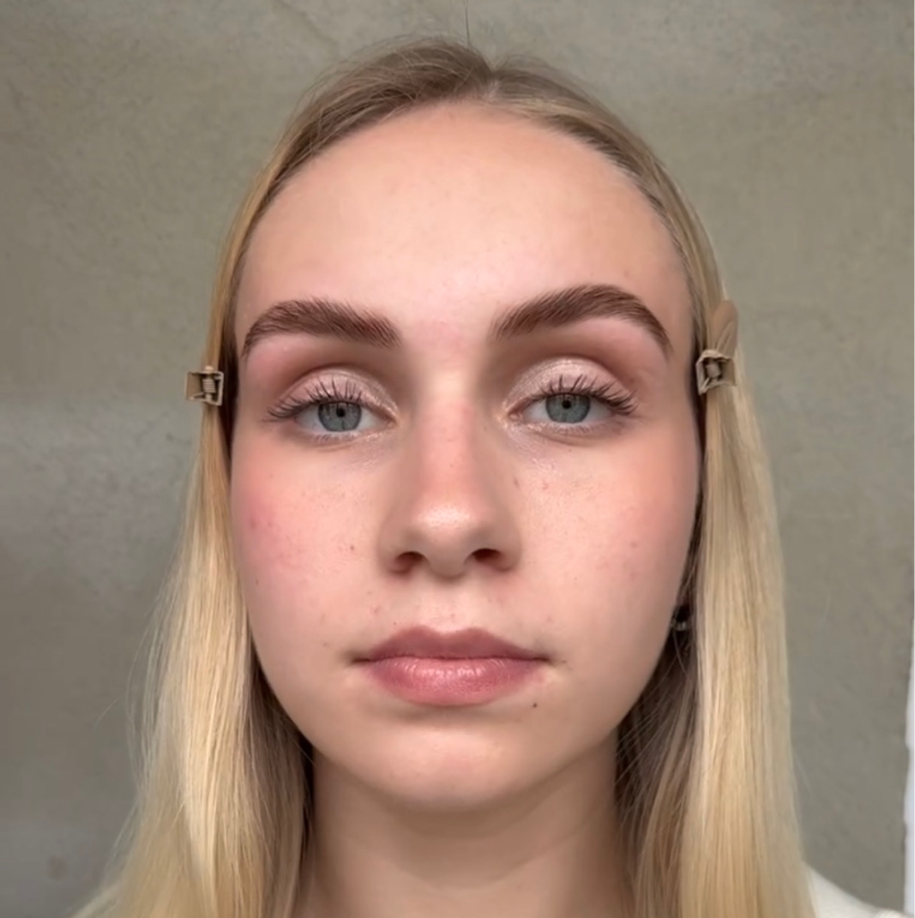 Удаление волос на лице