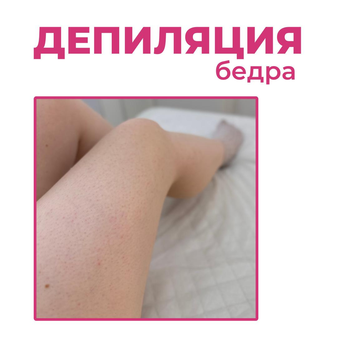 Ноги: бедра