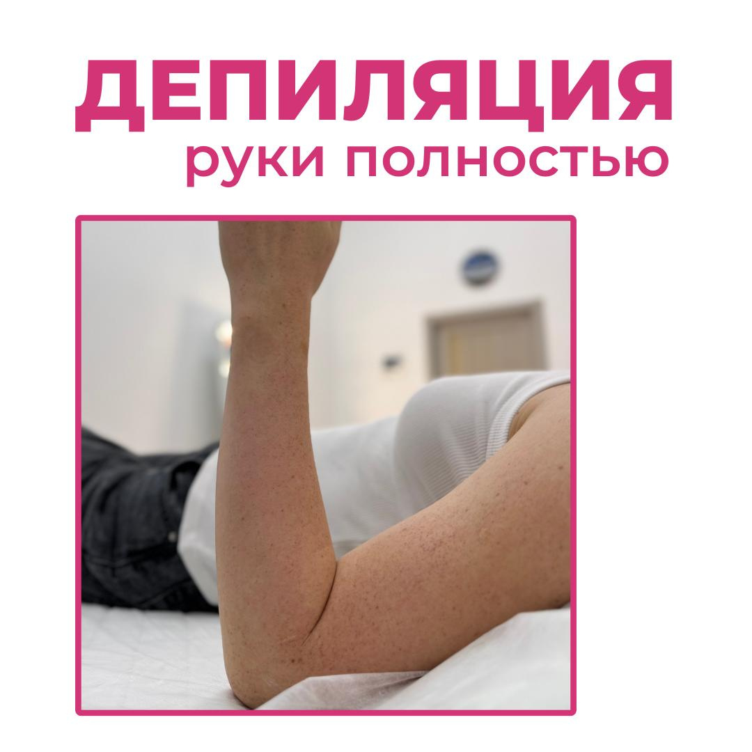 Руки полностью