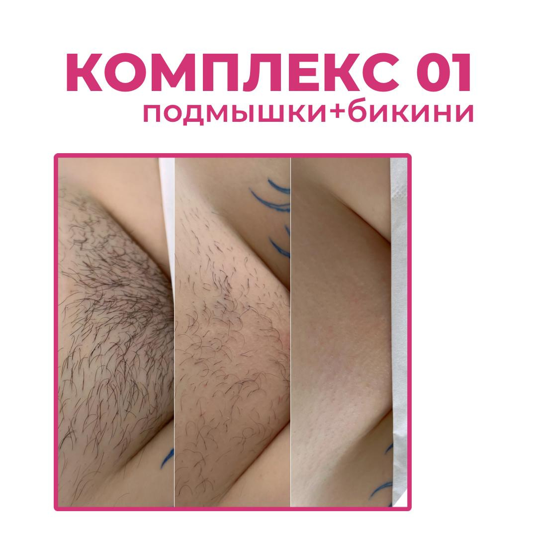Комплекс 01 (подмышки+бикини)