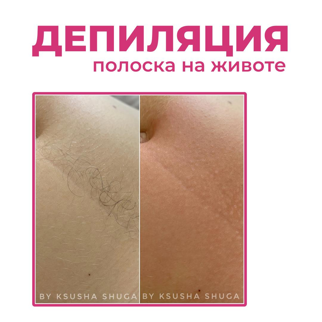 Полоска на животе