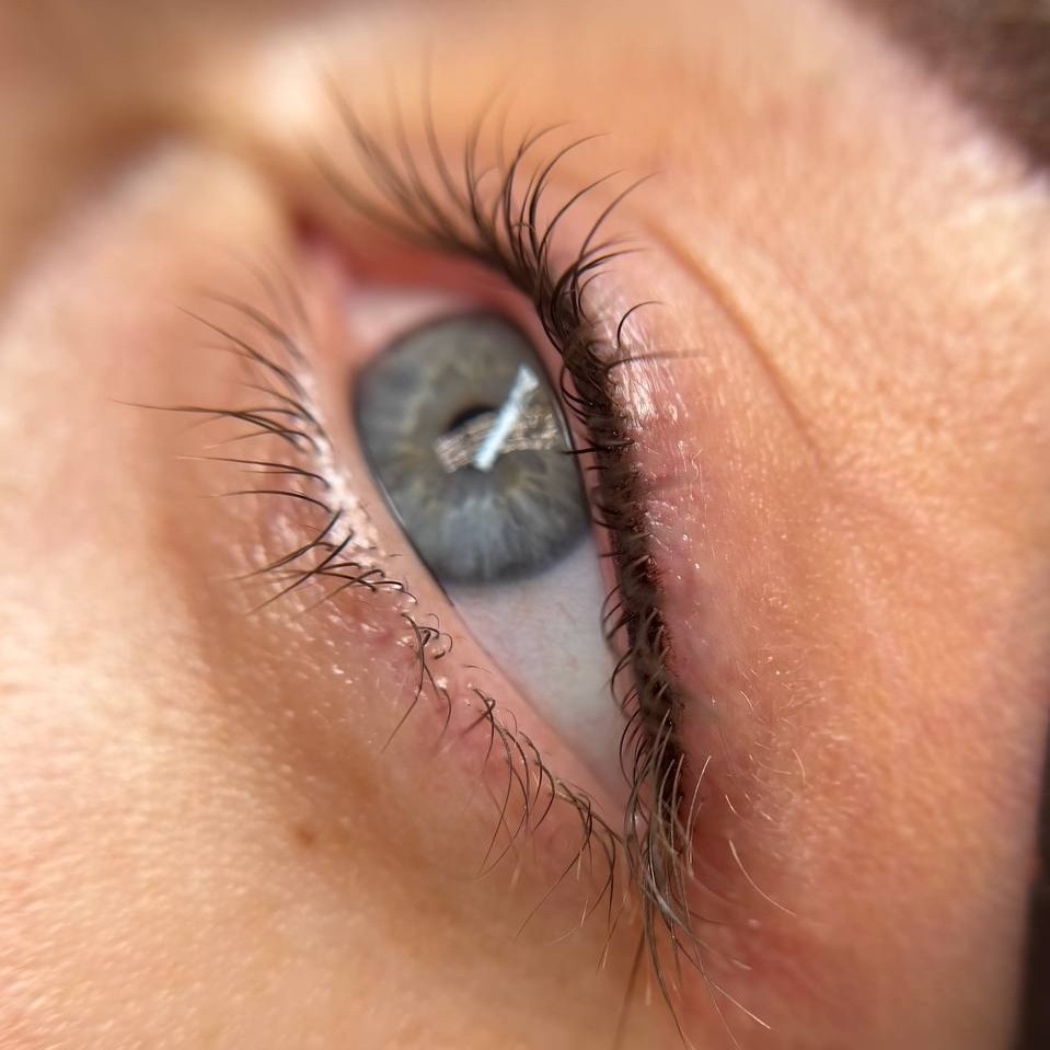 2- ПМ межресничка