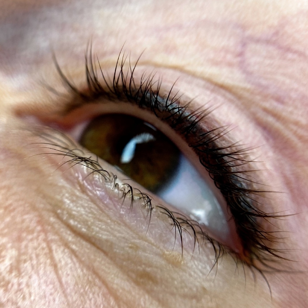 5- ПМ пушистая межресничка