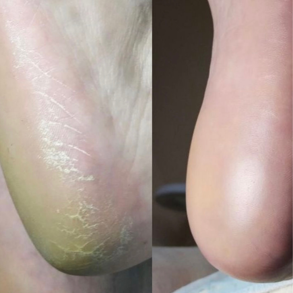 Smart педикюр без покрытия