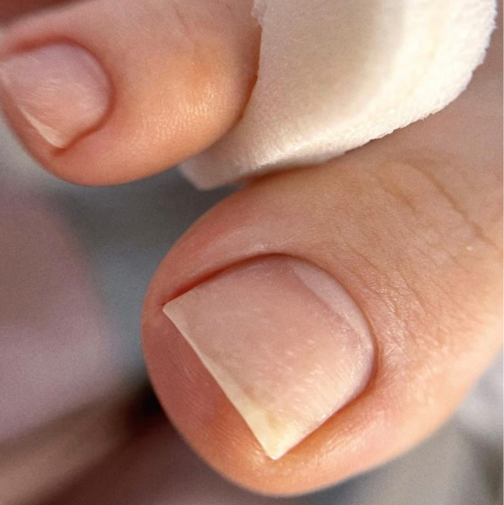 Обработка пальчиков без покрытия