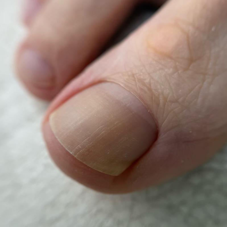 Педикюр (обработка пальчиков) без покрытия