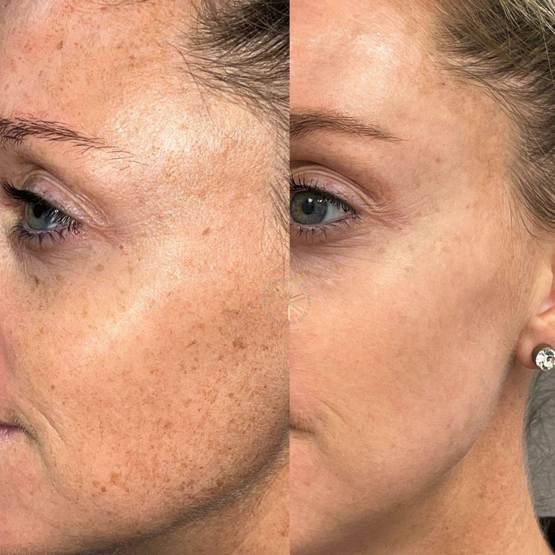 «КОРОЛЕВСКИЙ ЭФФЕКТ» Anti-age