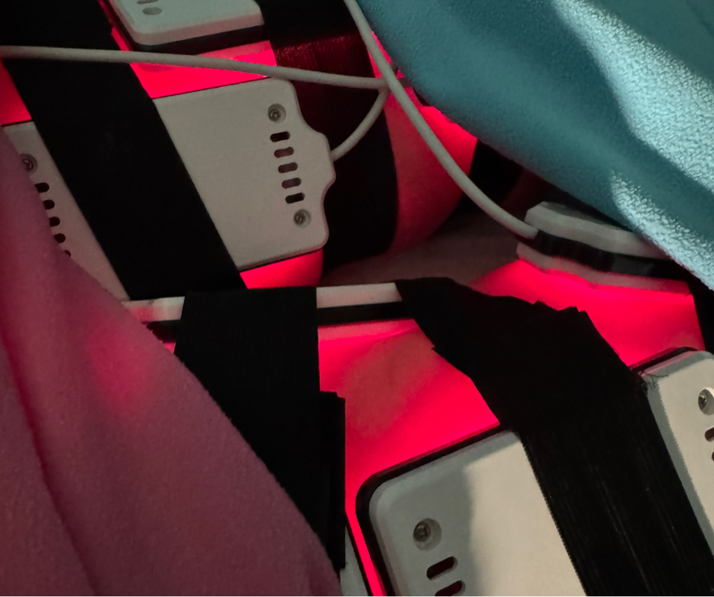 Лазерный липолиз