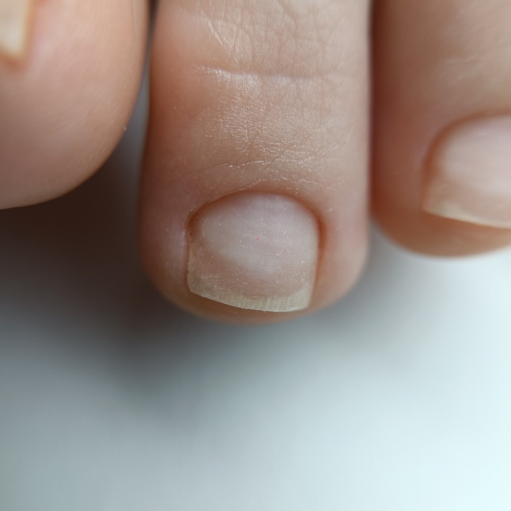 Педикюр обработка ногтей без покрытия