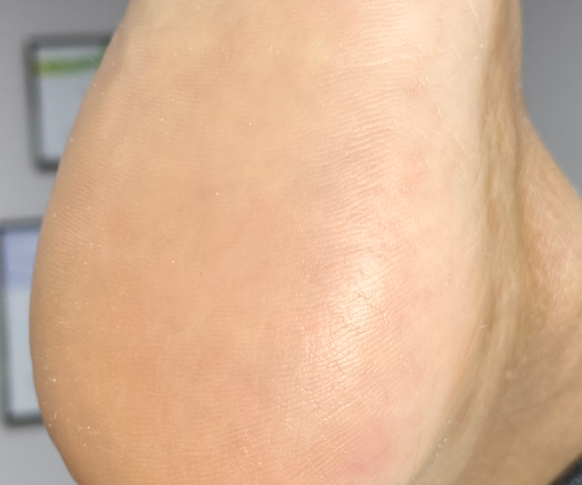 обработка стоп и пальцев без покрытия