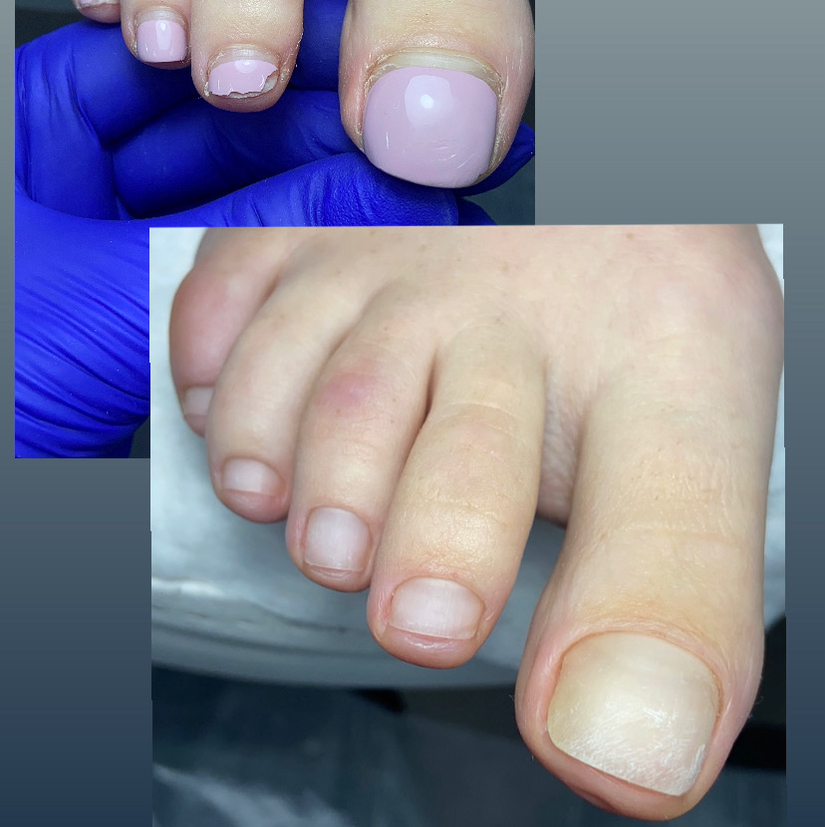 Обработка пальчиков без покрытия (ноги)