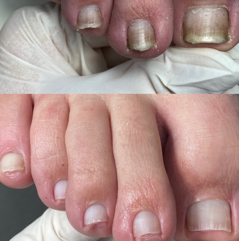 Педикюр мужской