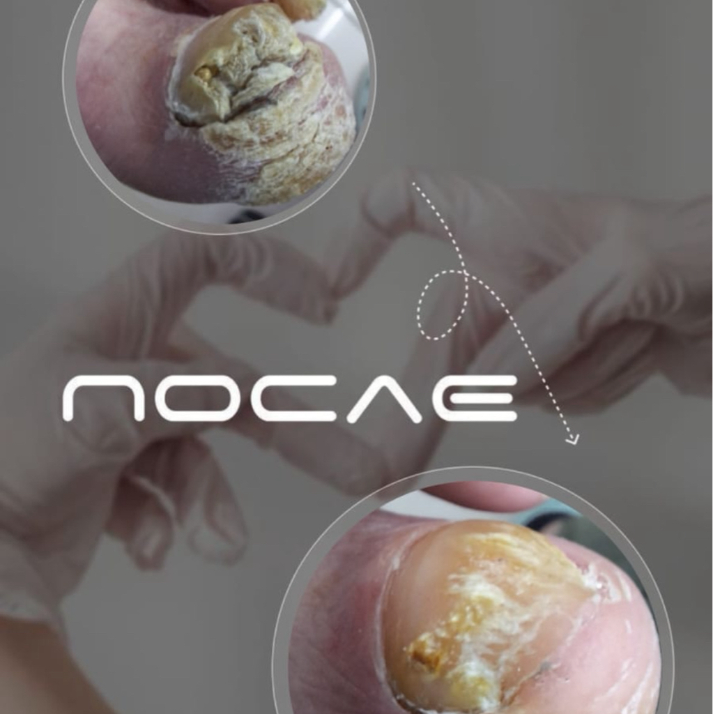 Подо-педикюр 2 категории