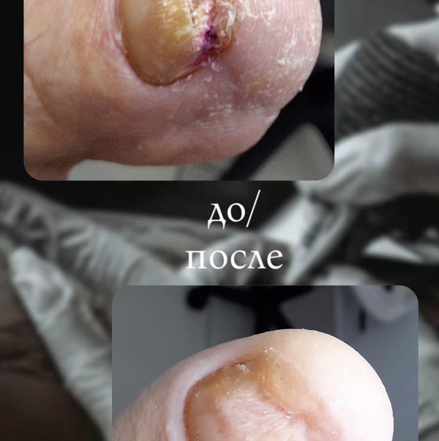 Подо-педикюр 1 категории