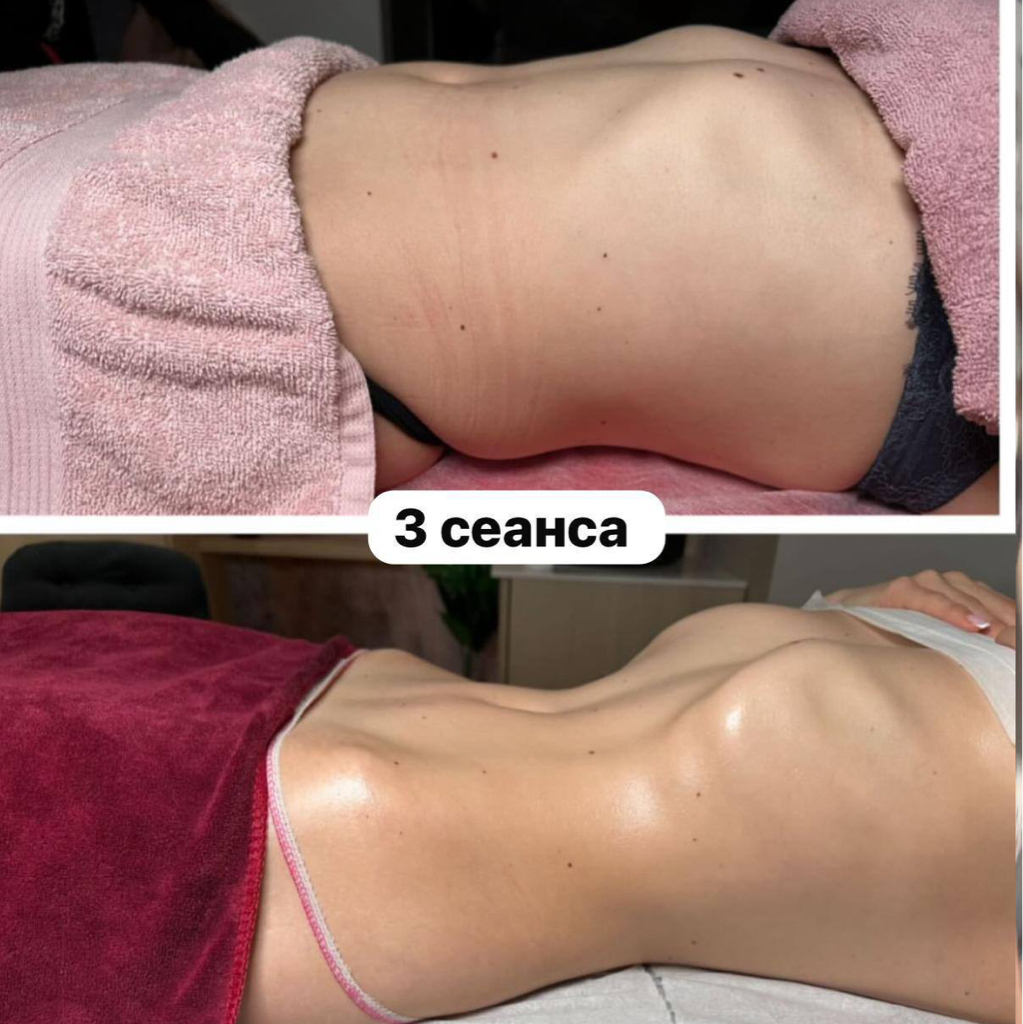 Висцеральный массаж (Живот, бока)