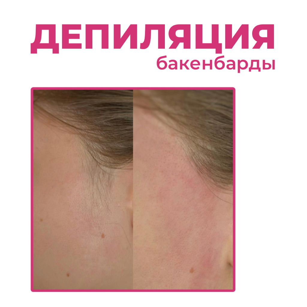 Банкенбарды