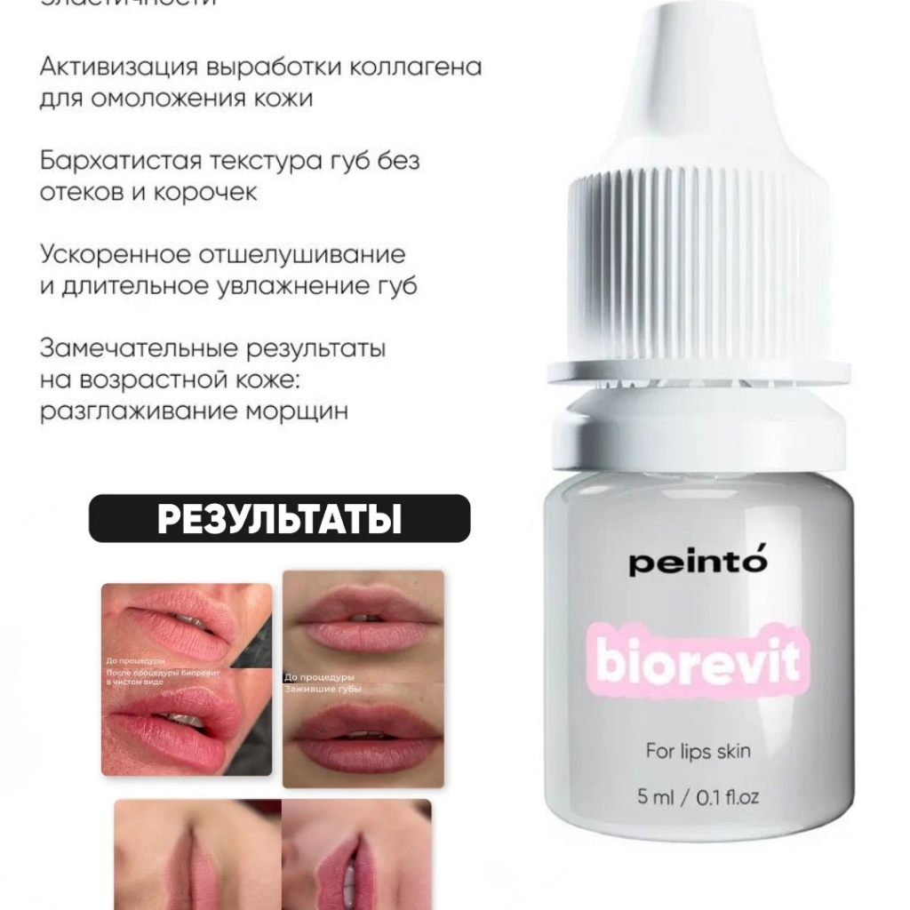 Биоревитализация губ