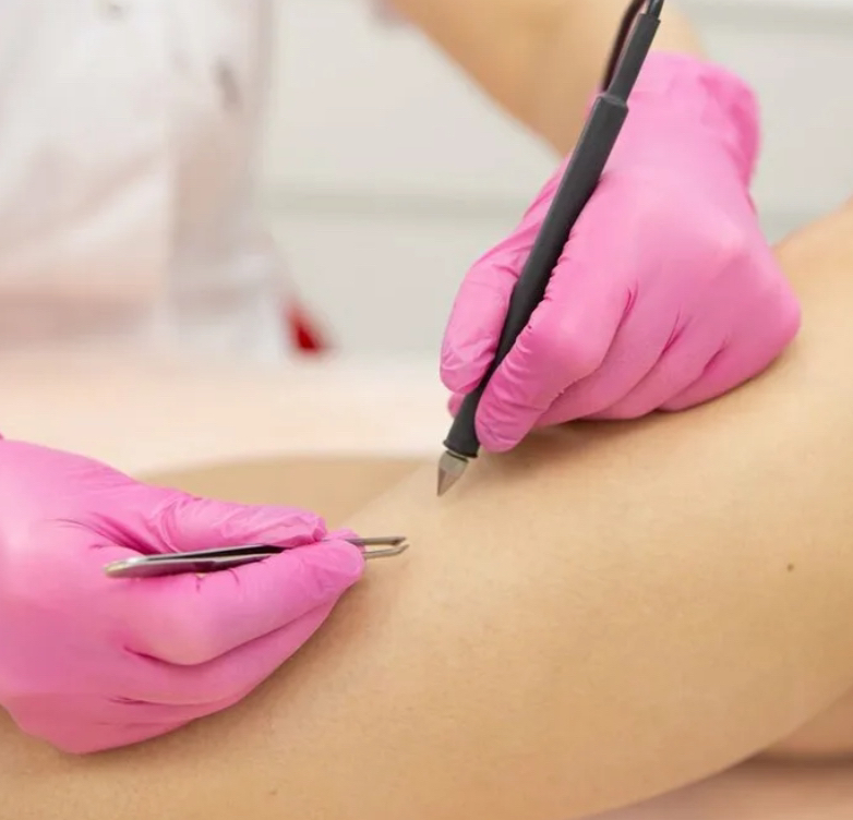 Минимальная стоимость одной процедуры