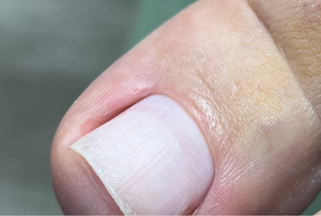 Педикюр( обработка пальчиков без покрытия )