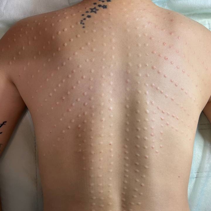 Сосудистый этап