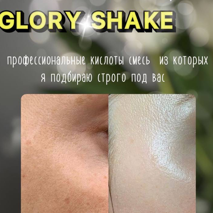 ПИЛИНГ GLORY SHAKE