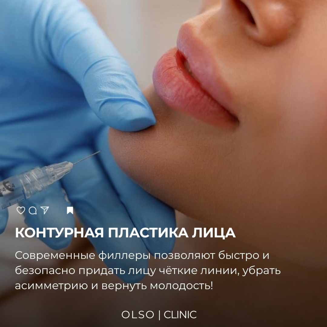 Контурная пластика лица