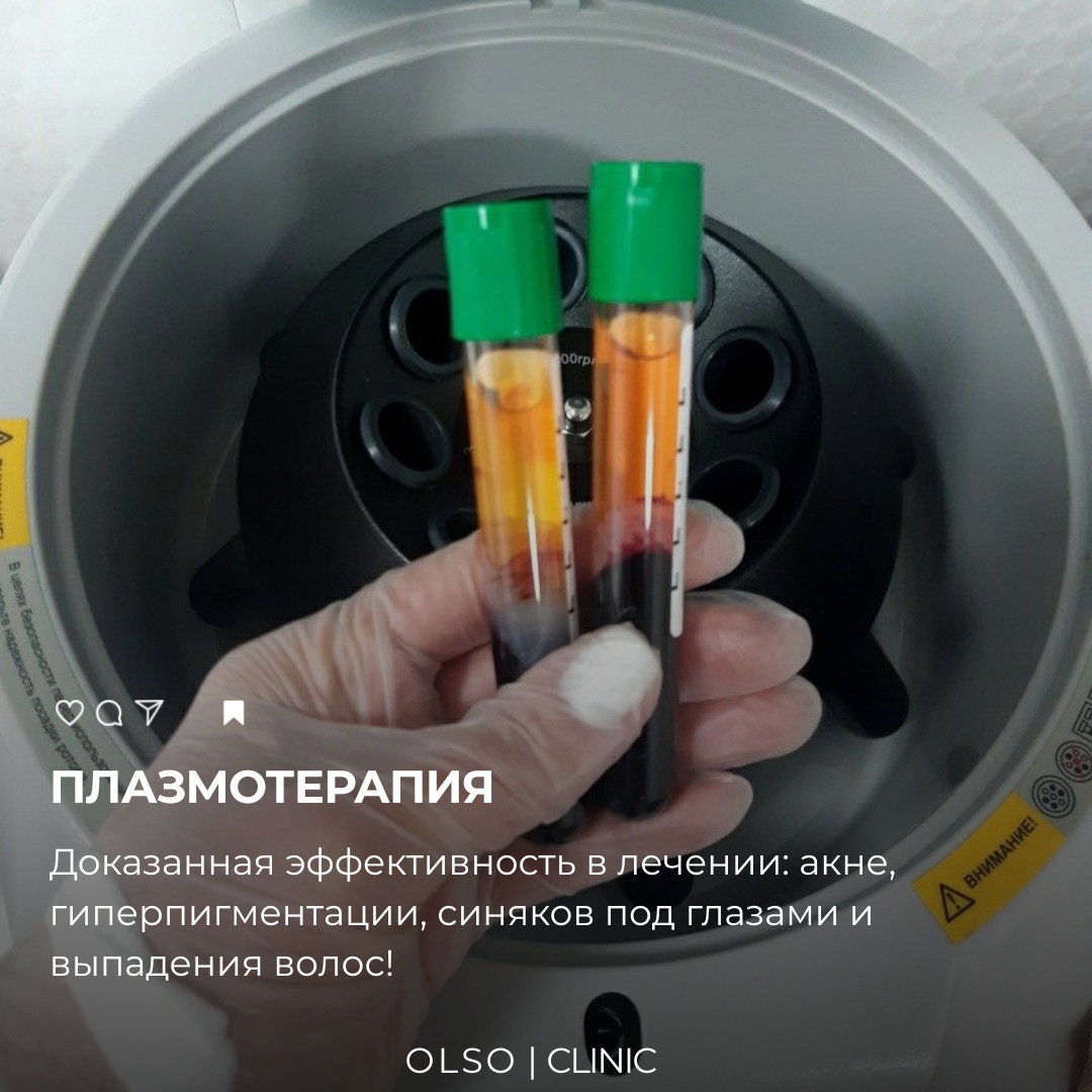 Плазматерапия