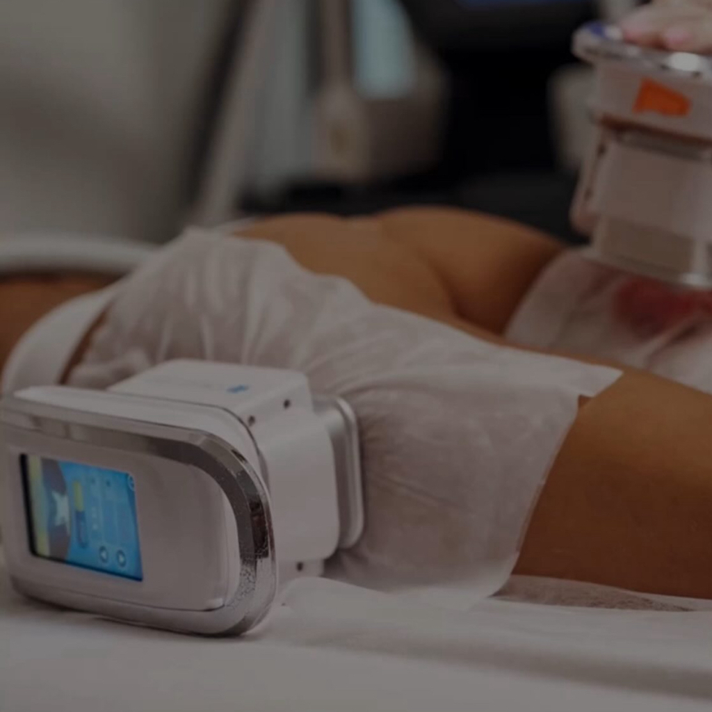 Криолиполиз