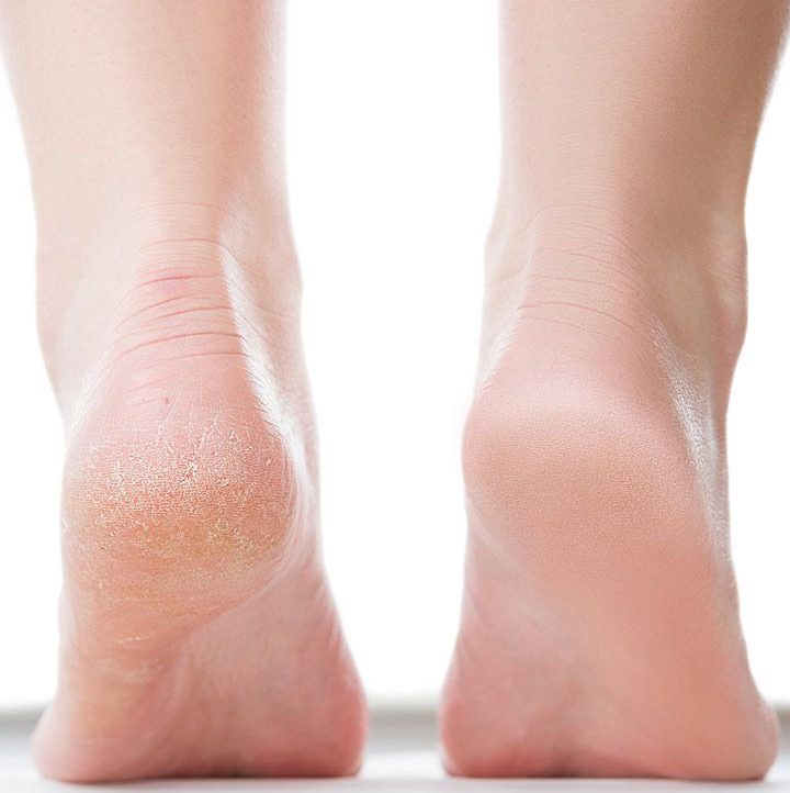 Педикюр-обработка только стопы