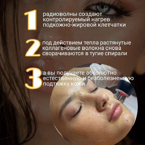 Rf- лифтинг лица по абонементу 5 процедур.4500₽