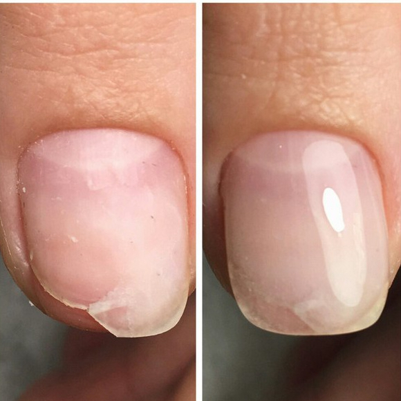 Ремонт ногтей