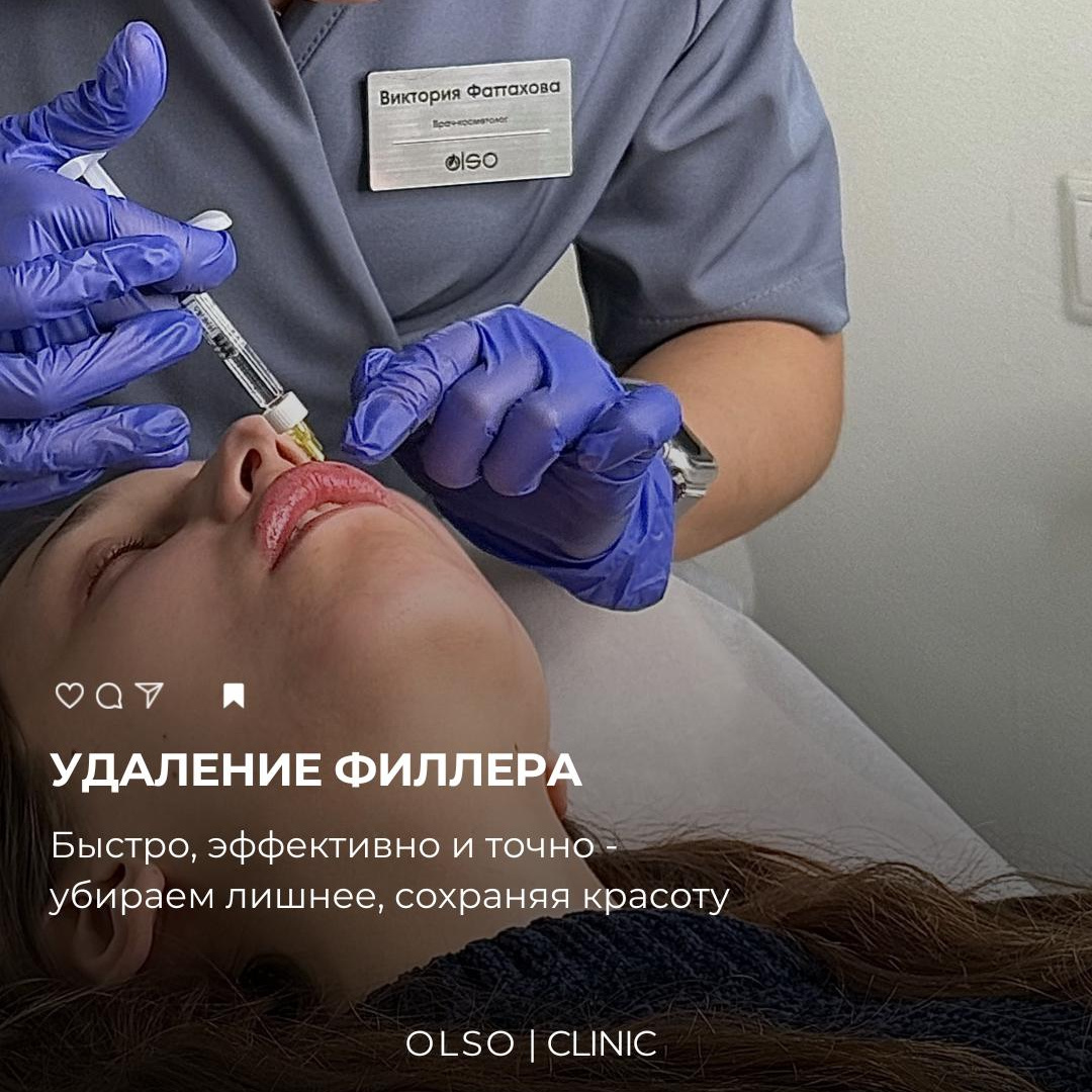 Удаление филлера