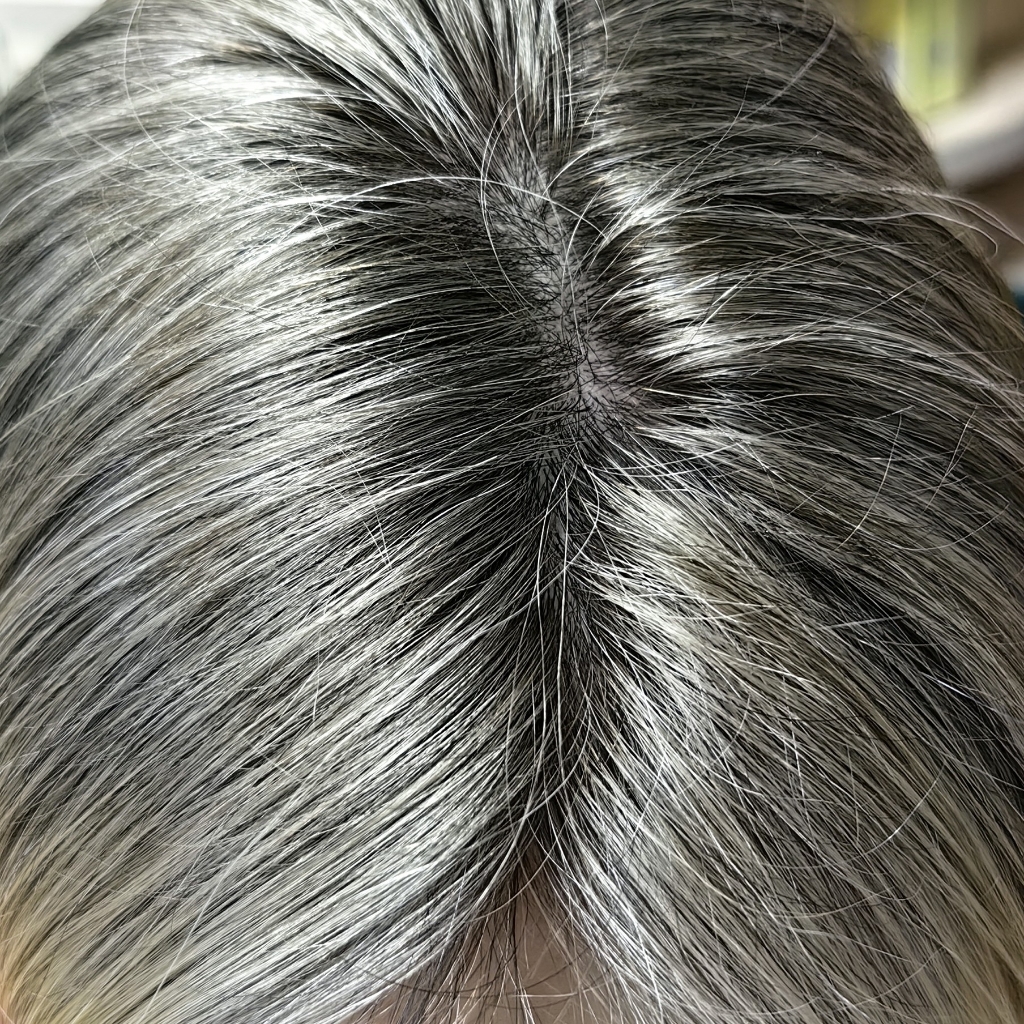 Пилинг кожи головы