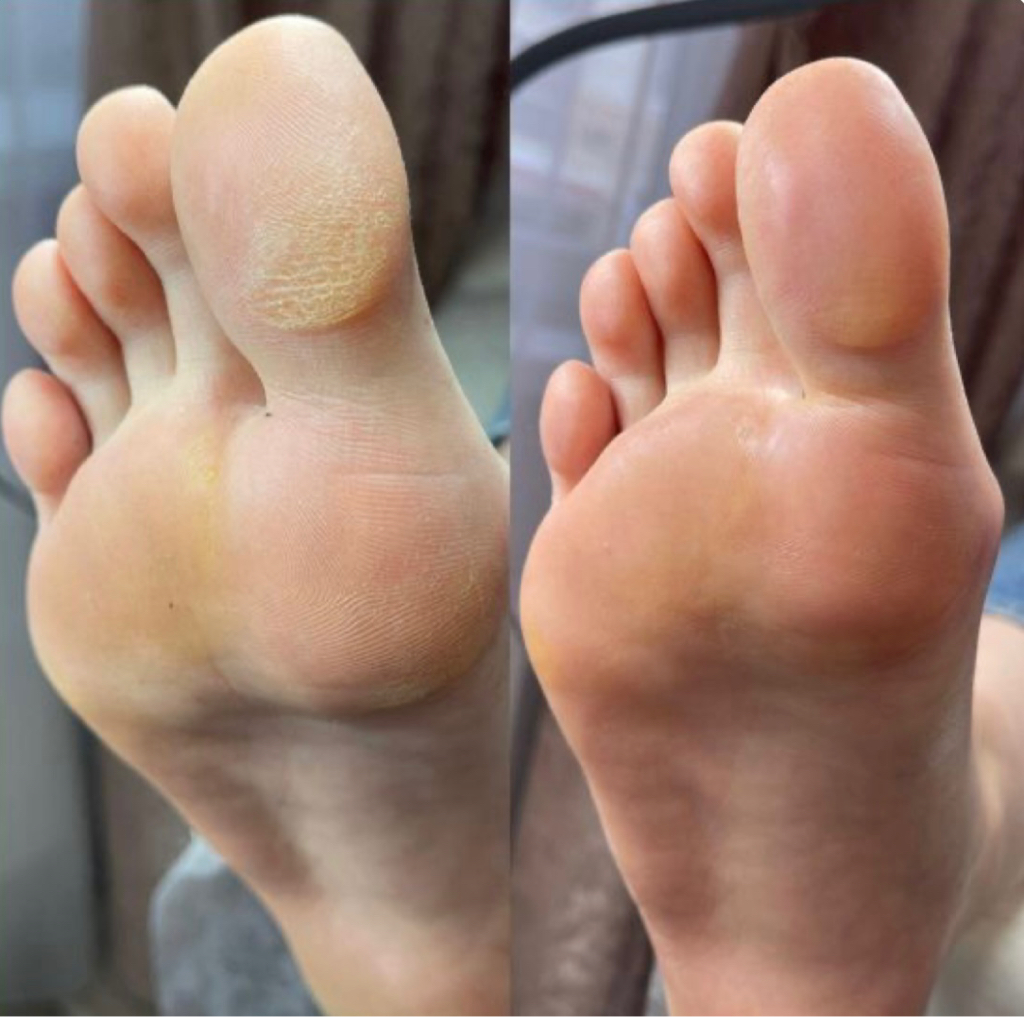 Обработка стопы и пальчиков без покрытия
