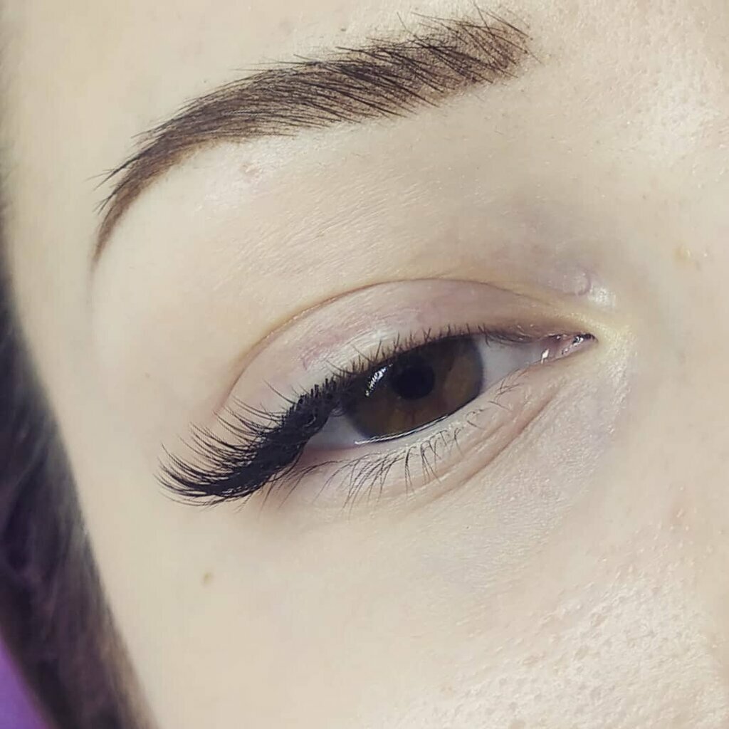 Уголки глаз