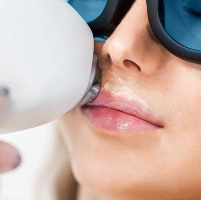 Верхняя губа