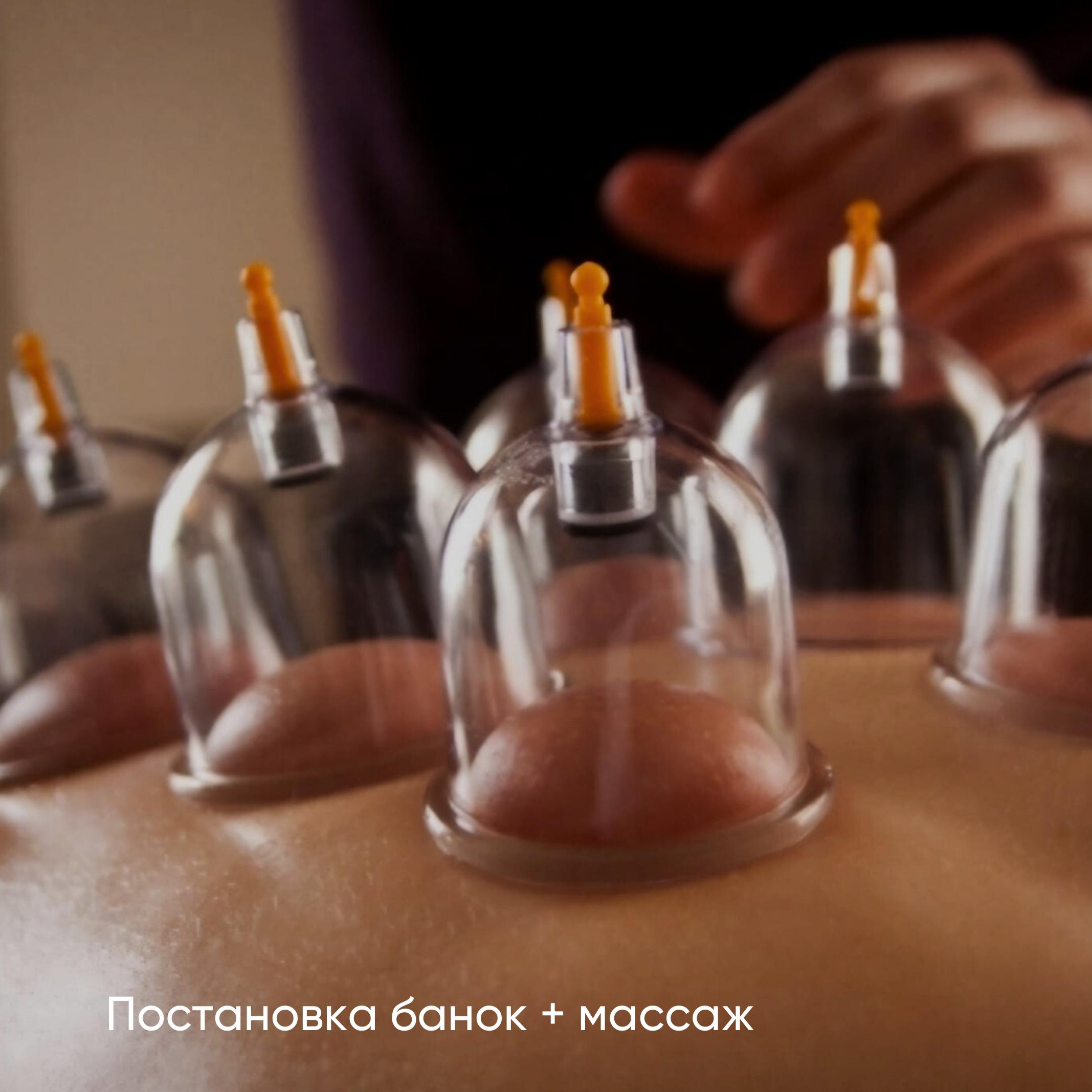Статичная постановка банок с массажем тела  (1 час)
