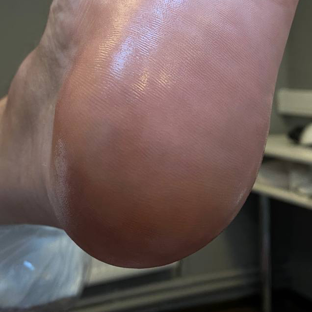 Комплекс - Мужской гигиенический маникюр и педикюр