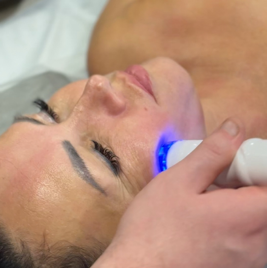 30мин5с Абонемент RF-массаж лица