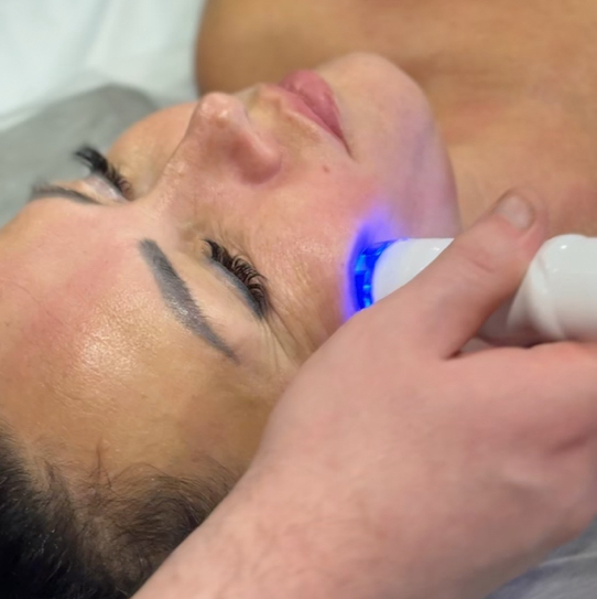 30мин10с Абонемент RF-массаж лица