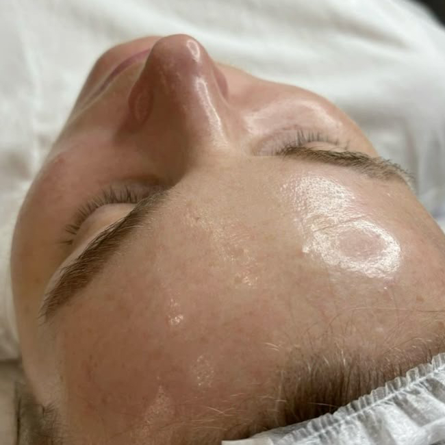 Пилинг Альфа Комплекс