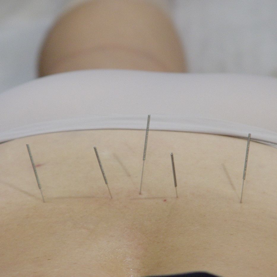 Процедура ТКМ