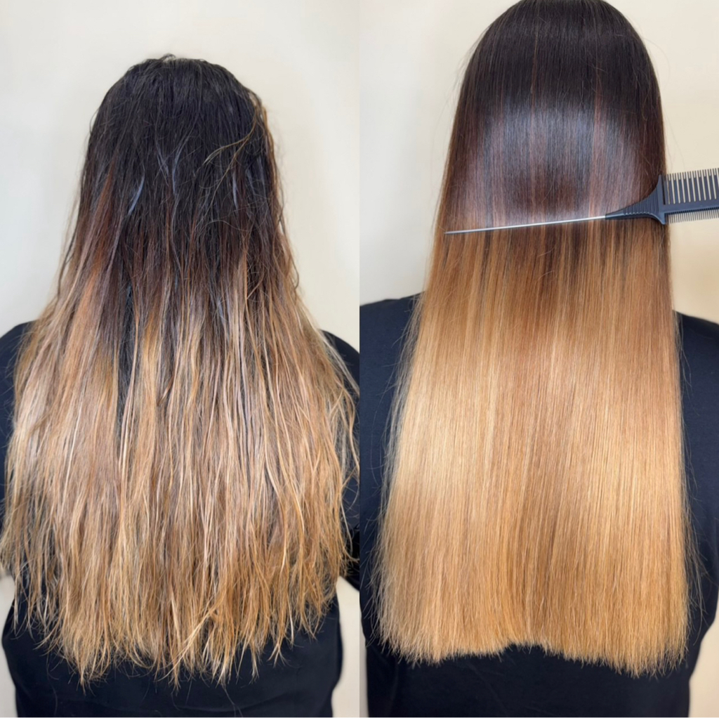 Каутеризация