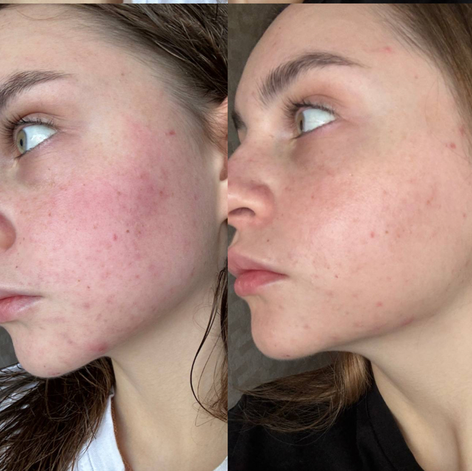 Домашний уход