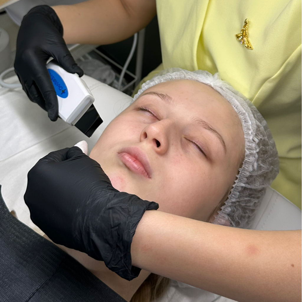 УЗ чистка + пилинг