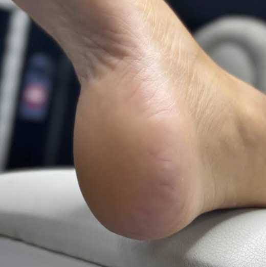 Педикюр пяточка