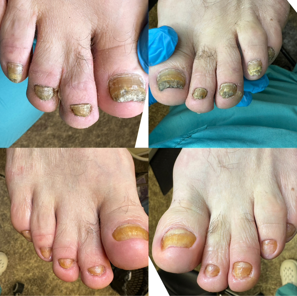 Частичный педикюр (пальчики) ПОДОЛОГИЯ