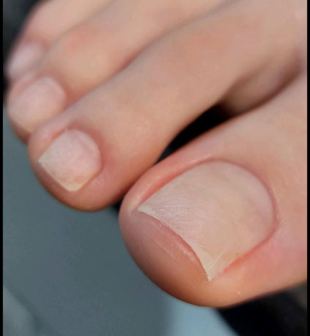 Педикюр гигиенический