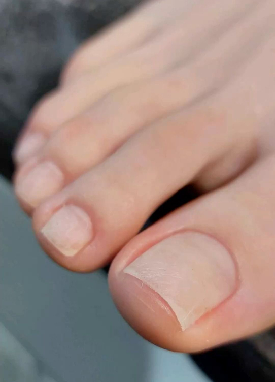 Обработка пальчиков